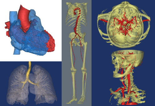 Clinical Imaging Analytics